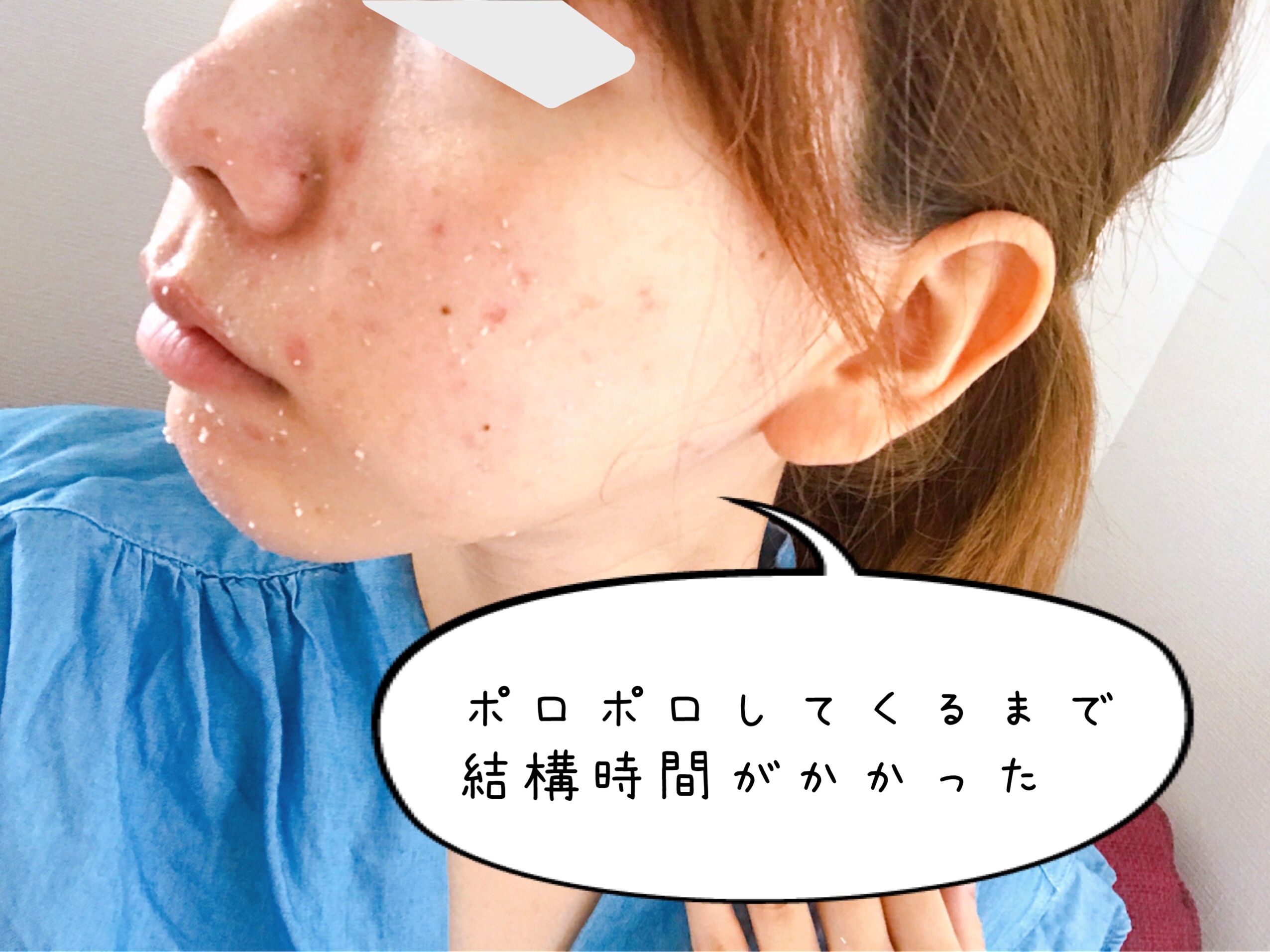 100均コスメ ダイソー ピーリングジェル