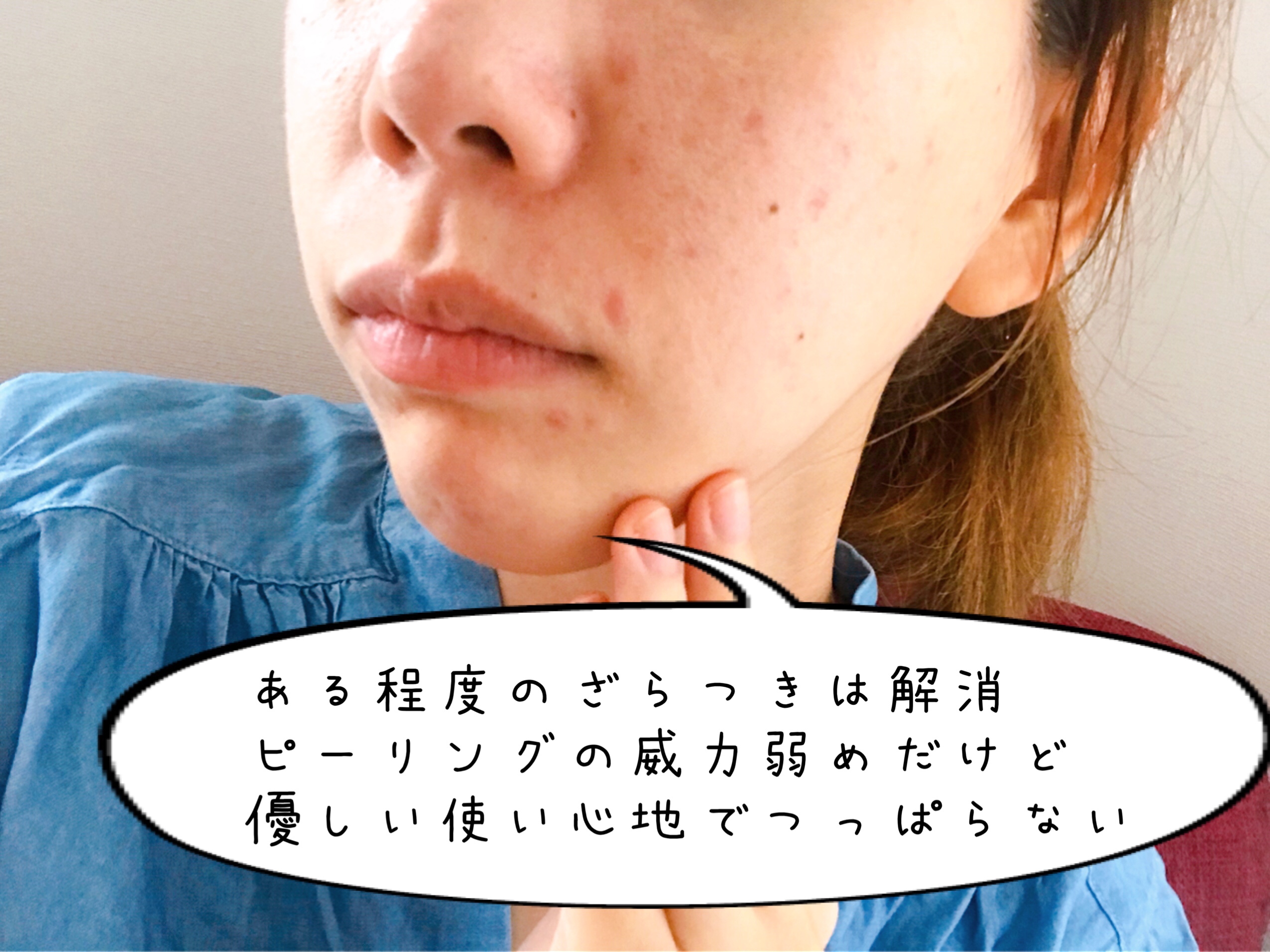 100均コスメ ダイソー ピーリングジェル